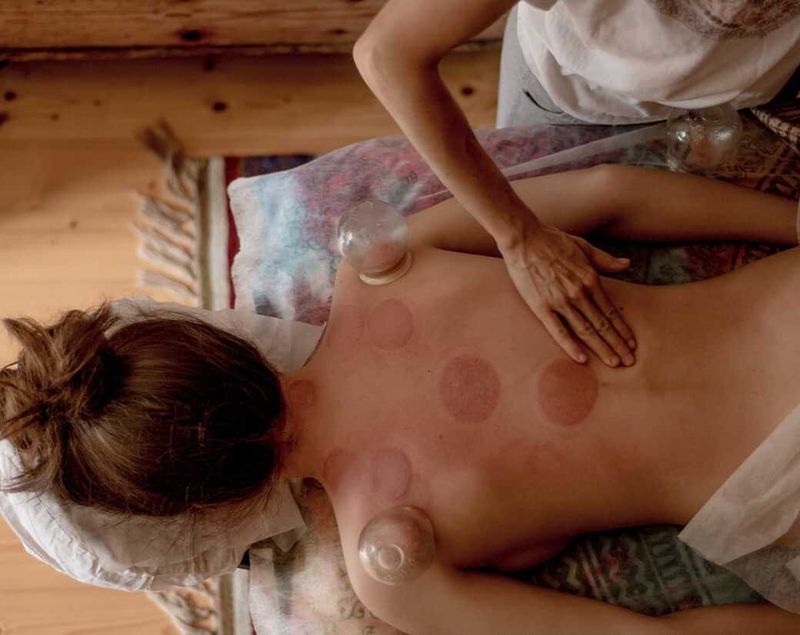 Cupping terapi bekam Elvara